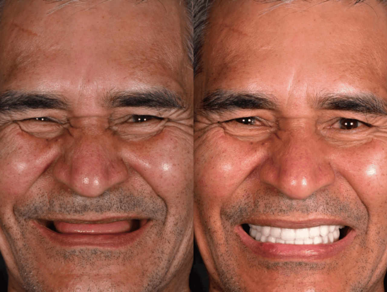Man Smiling