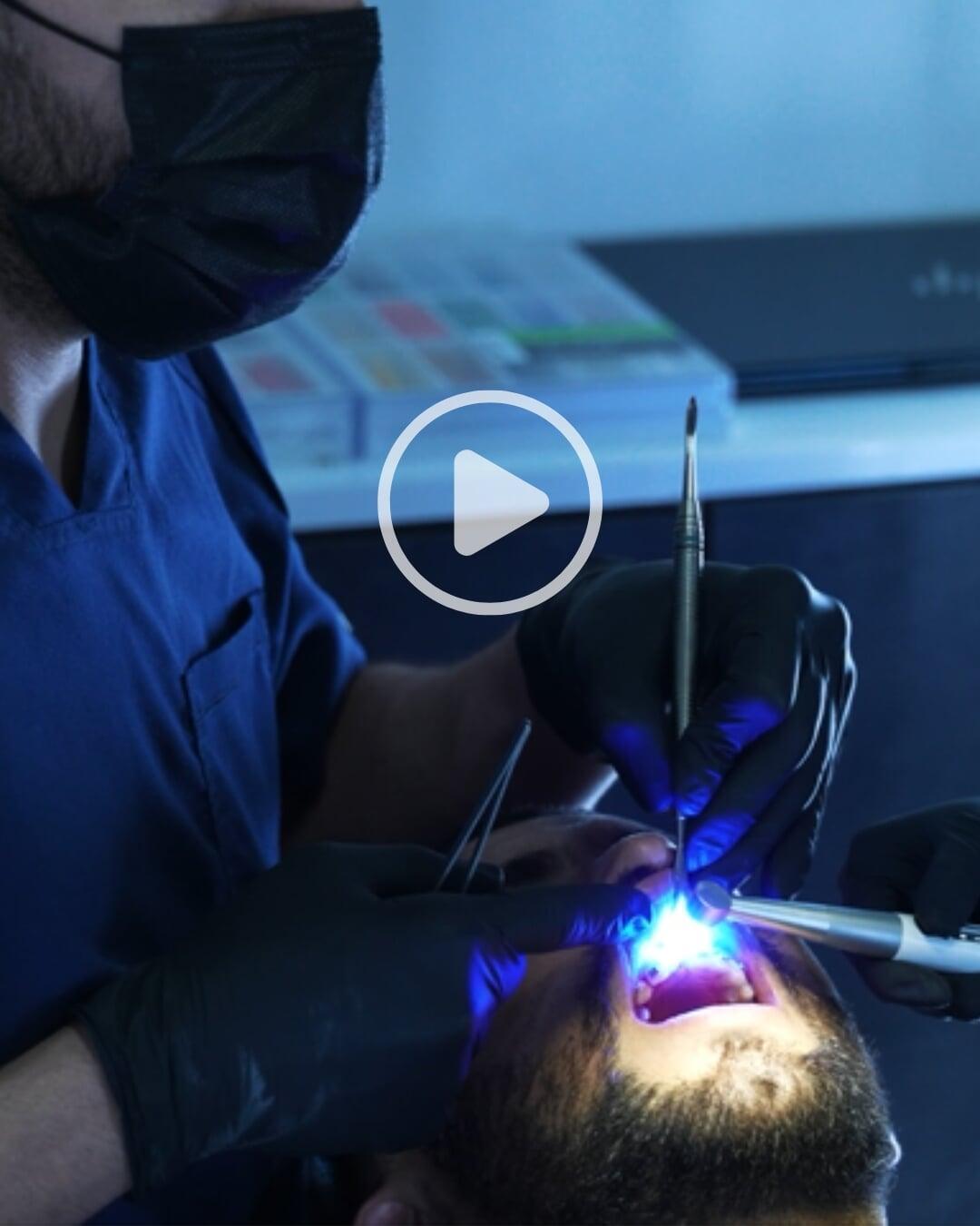 Dentist placing a dental implant in a patient’s mouth during a professional procedure in a modern clinic.