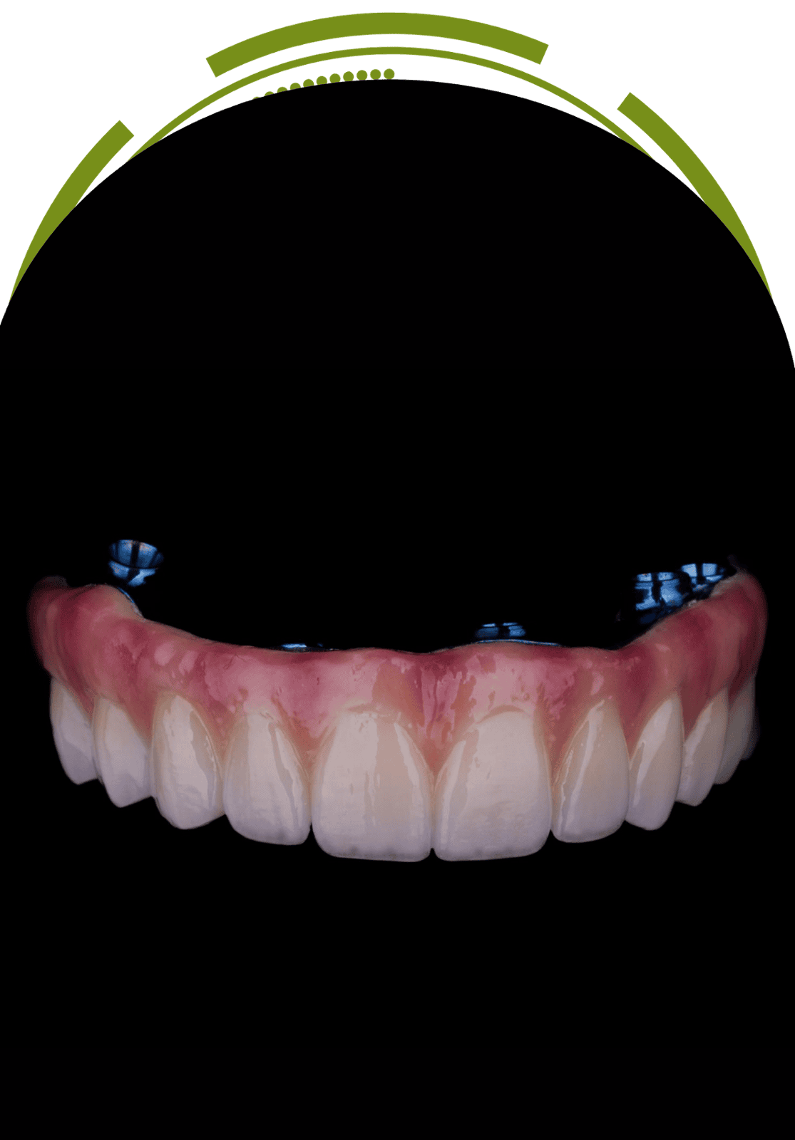 Trilor Dentures