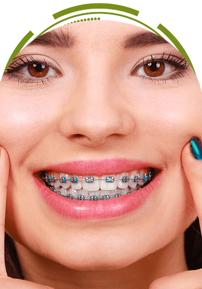 Smiling young woman with metal braces – orthodontic treatment for straight teeth.  EnamelDent 